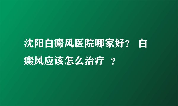 沈阳白癜风医院哪家好？ 白癜风应该怎么治疗  ？