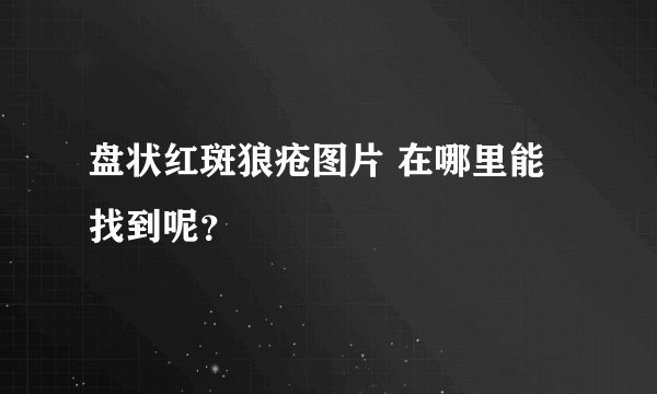 盘状红斑狼疮图片 在哪里能找到呢？