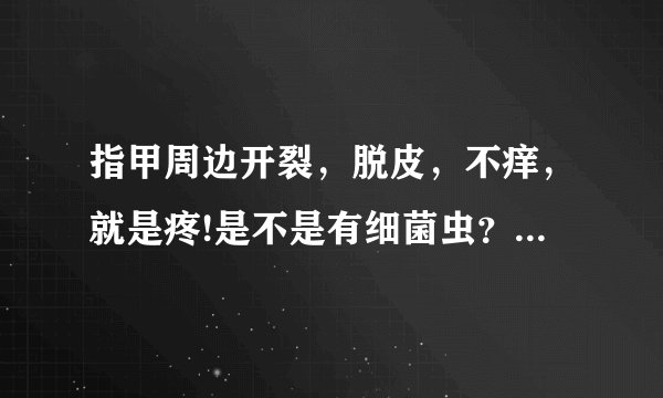 指甲周边开裂，脱皮，不痒，就是疼!是不是有细菌虫？要...