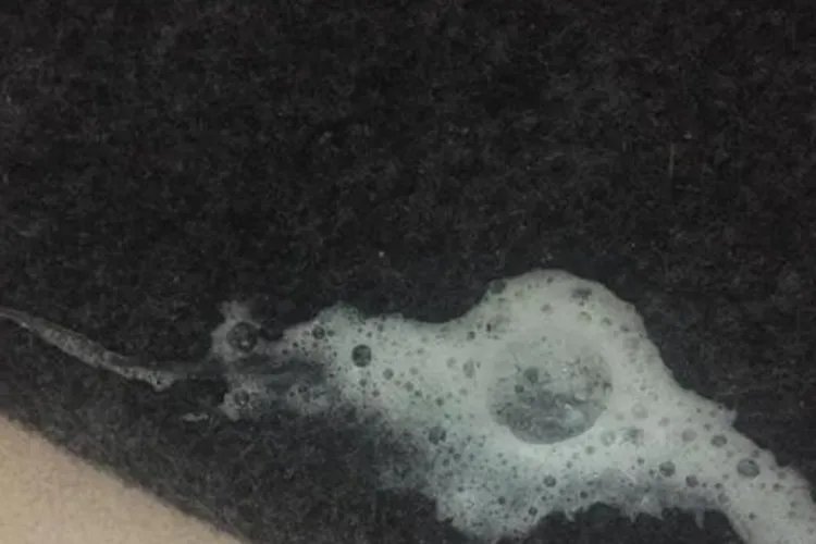 痰的颜色与对应图片