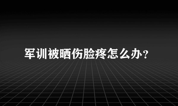 军训被晒伤脸疼怎么办？