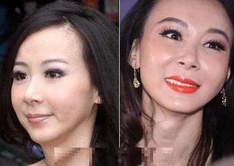 娱乐圈有哪些本来就长得很好看却还整容的明星?