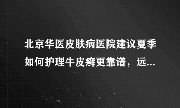 北京华医皮肤病医院建议夏季如何护理牛皮癣更靠谱，远离牛皮癣困扰