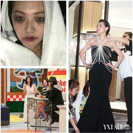 著名女星小s满脸淤青出镜备受热议网友们纷纷调侃又遭家暴了