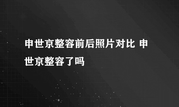 申世京整容前后照片对比 申世京整容了吗