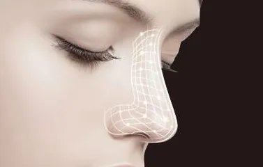 东莞歪鼻梁整形医院哪里好_知名歪鼻梁美容整形医院有哪些【附价格】