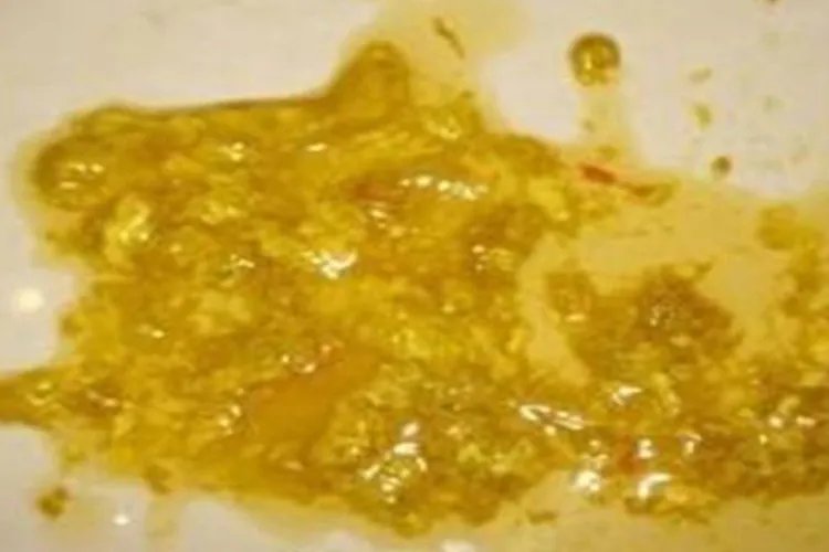 芝士过敏症状图