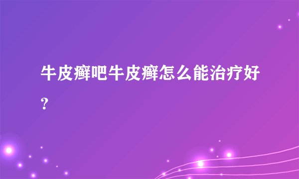 牛皮癣吧牛皮癣怎么能治疗好？