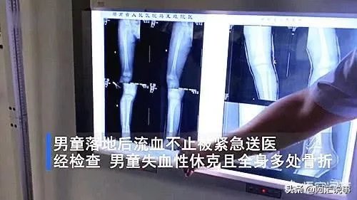 长沙6岁男童被锁家中撑伞从5楼跳下,全身多处骨折,怎么回事?