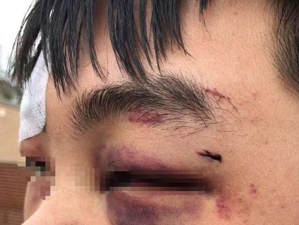 在澳留学生为何被围殴？