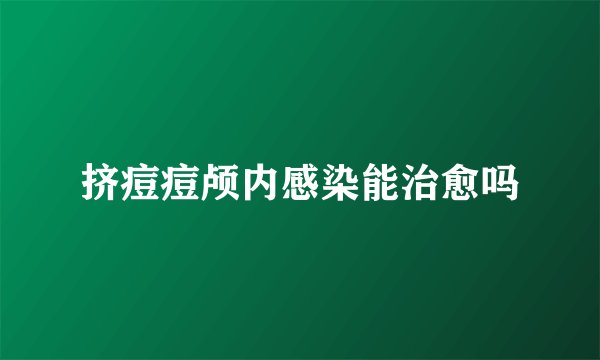 挤痘痘颅内感染能治愈吗