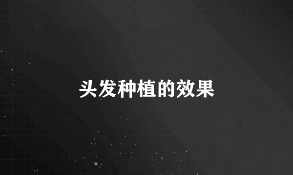 头发种植的效果