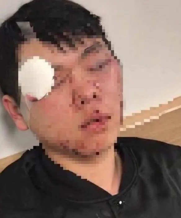在澳留学生为何被围殴?