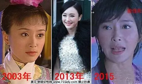 娱乐圈有哪些本来就长得很好看却还整容的明星?