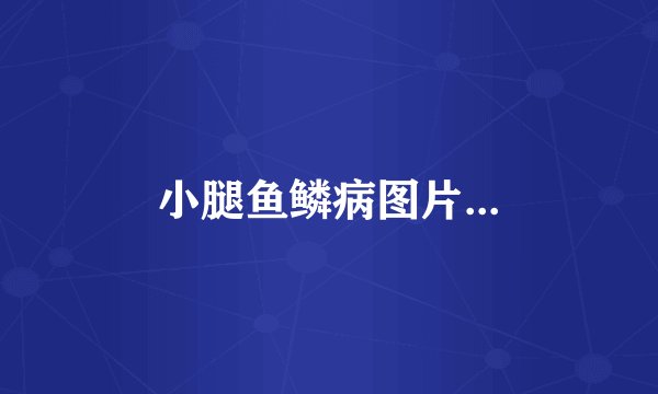 小腿鱼鳞病图片...