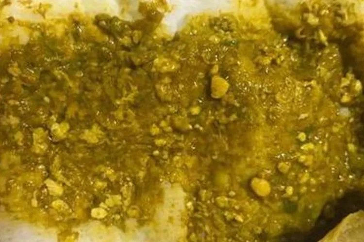 婴儿腹泻大便种类图解