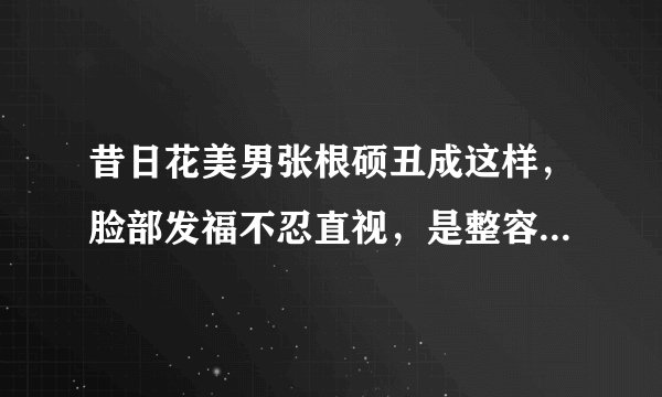 昔日花美男张根硕丑成这样，脸部发福不忍直视，是整容后遗症么？