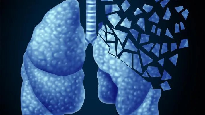 中医药可提高肺癌患者的生存质量