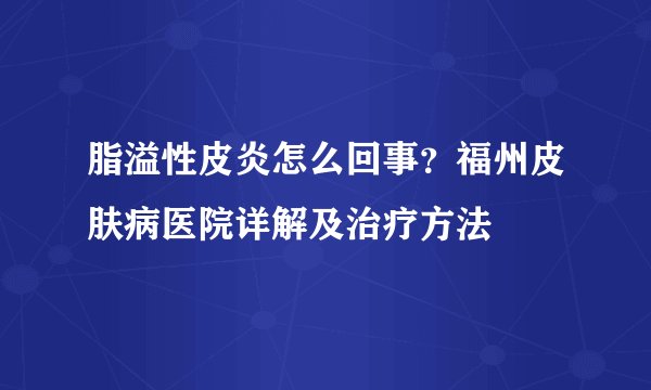 脂溢性皮炎怎么回事？福州皮肤病医院详解及治疗方法