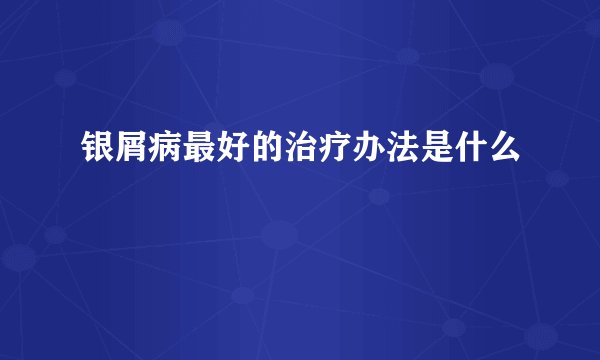 银屑病最好的治疗办法是什么