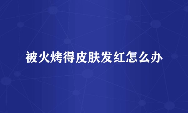 被火烤得皮肤发红怎么办