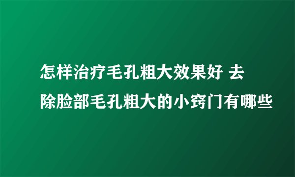 怎样治疗毛孔粗大效果好 去除脸部毛孔粗大的小窍门有哪些