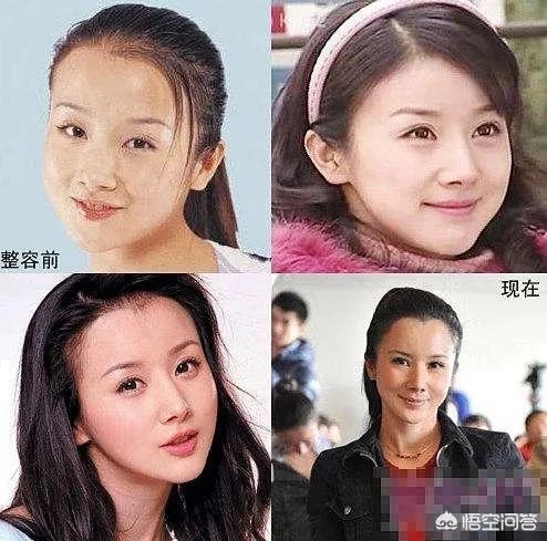 娱乐圈有哪些本来就长得很好看却还整容的明星?
