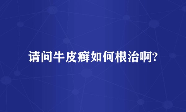 请问牛皮癣如何根治啊?