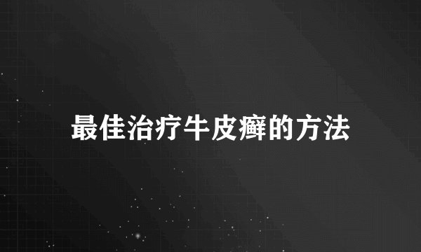 最佳治疗牛皮癣的方法