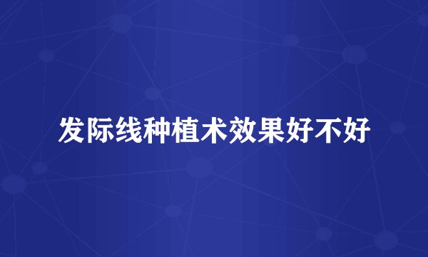 发际线种植术效果好不好