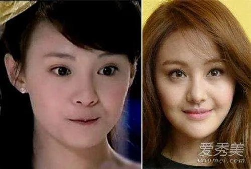 娱乐圈有哪些本来就长得很好看却还整容的明星?