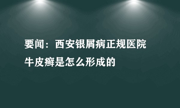 要闻：西安银屑病正规医院 牛皮癣是怎么形成的