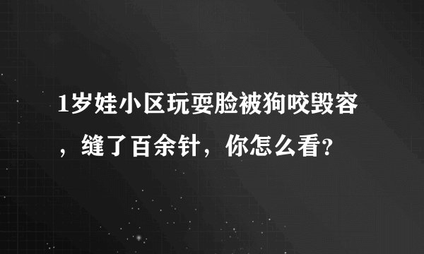 1岁娃小区玩耍脸被狗咬毁容，缝了百余针，你怎么看？