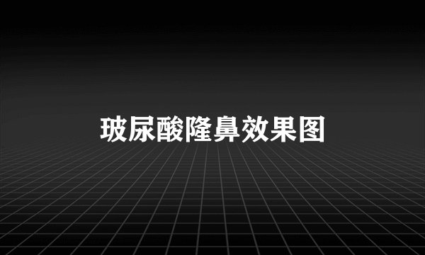 玻尿酸隆鼻效果图