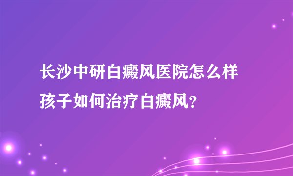 长沙中研白癜风医院怎么样 孩子如何治疗白癜风？